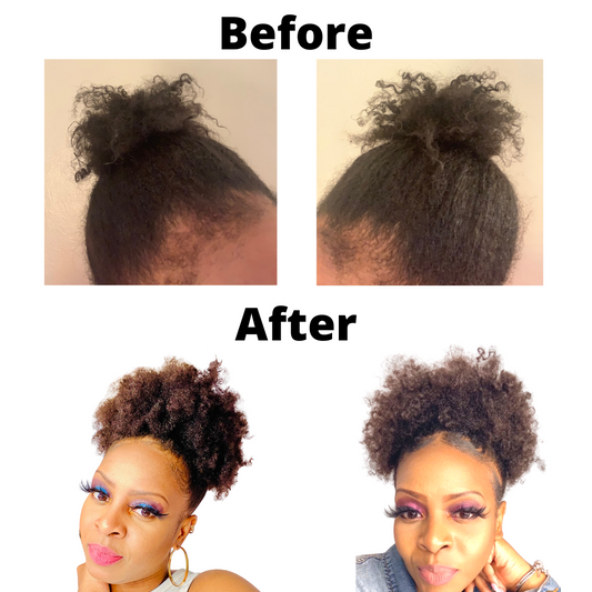 The Maximum Strength Hair Growth "Leave-In Liquid Duo"