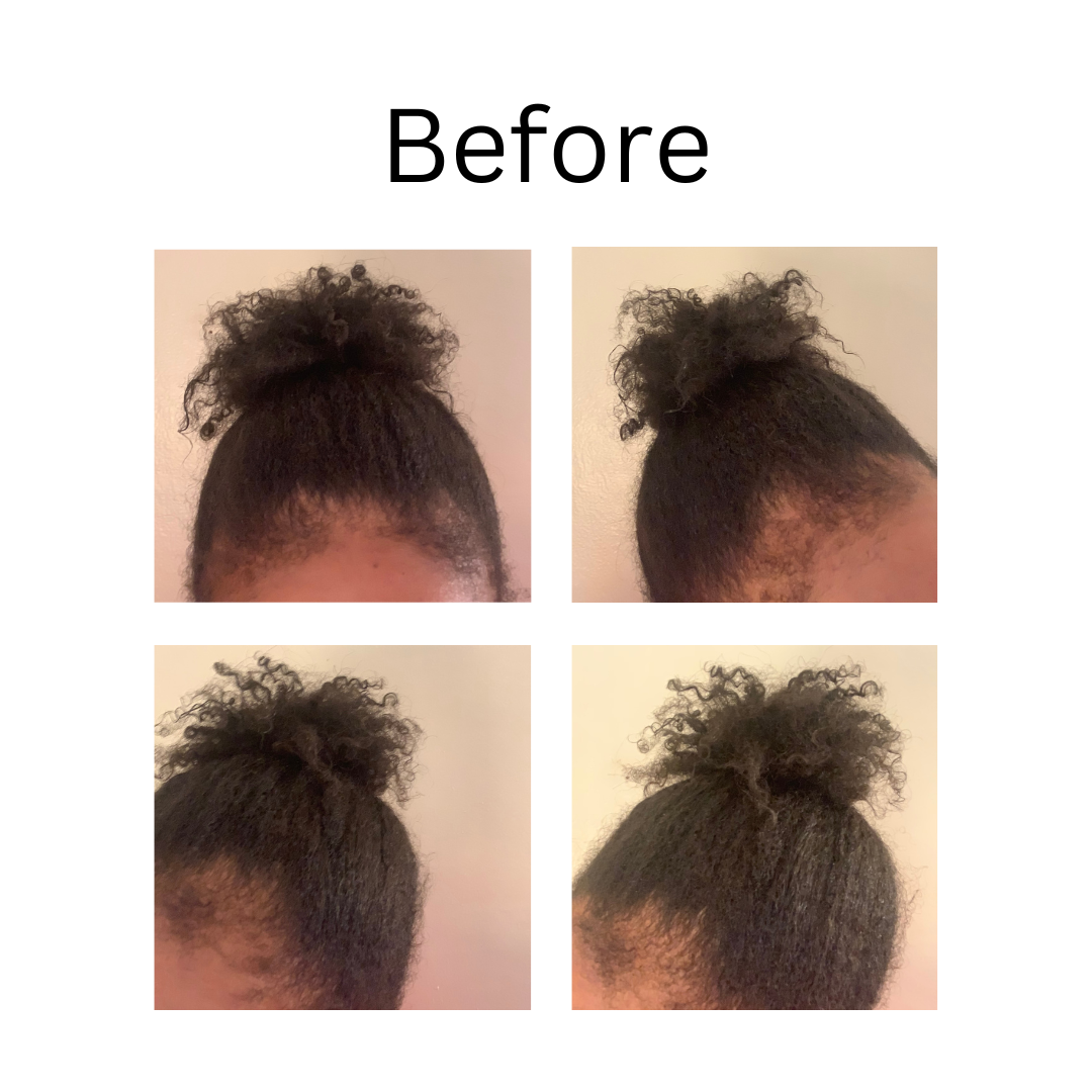 THE VIRAL Fermented Herbal Onion Rice Water Treatment (Rinse Out)